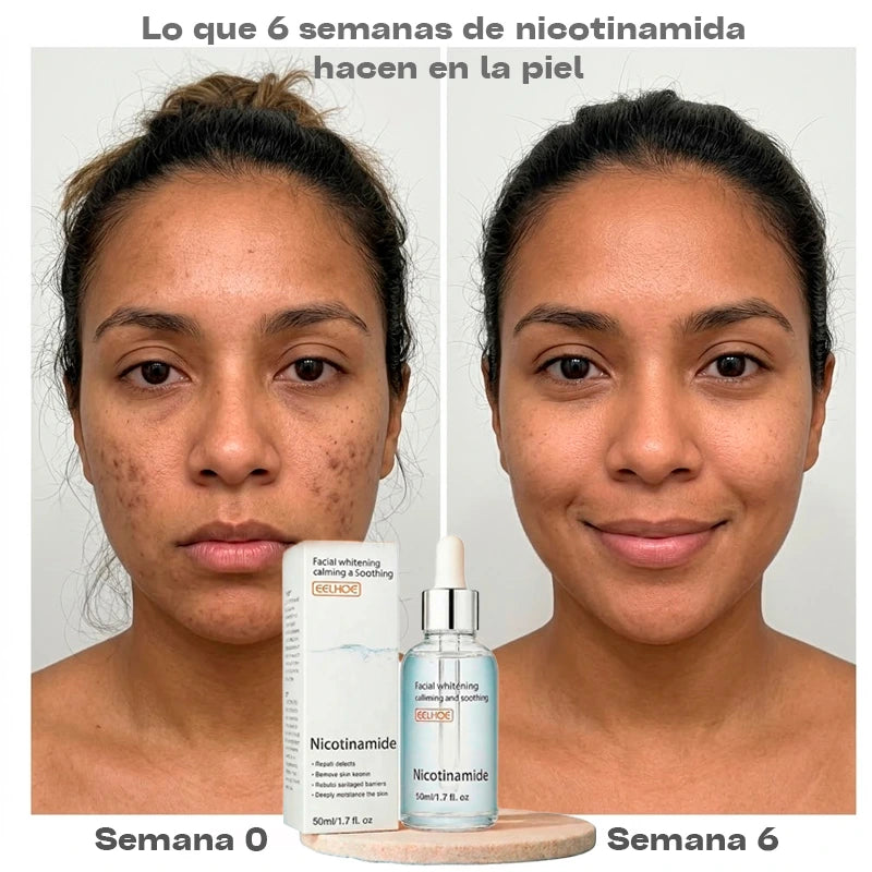 Sérum de nicotinamida para manchas Post-Acné