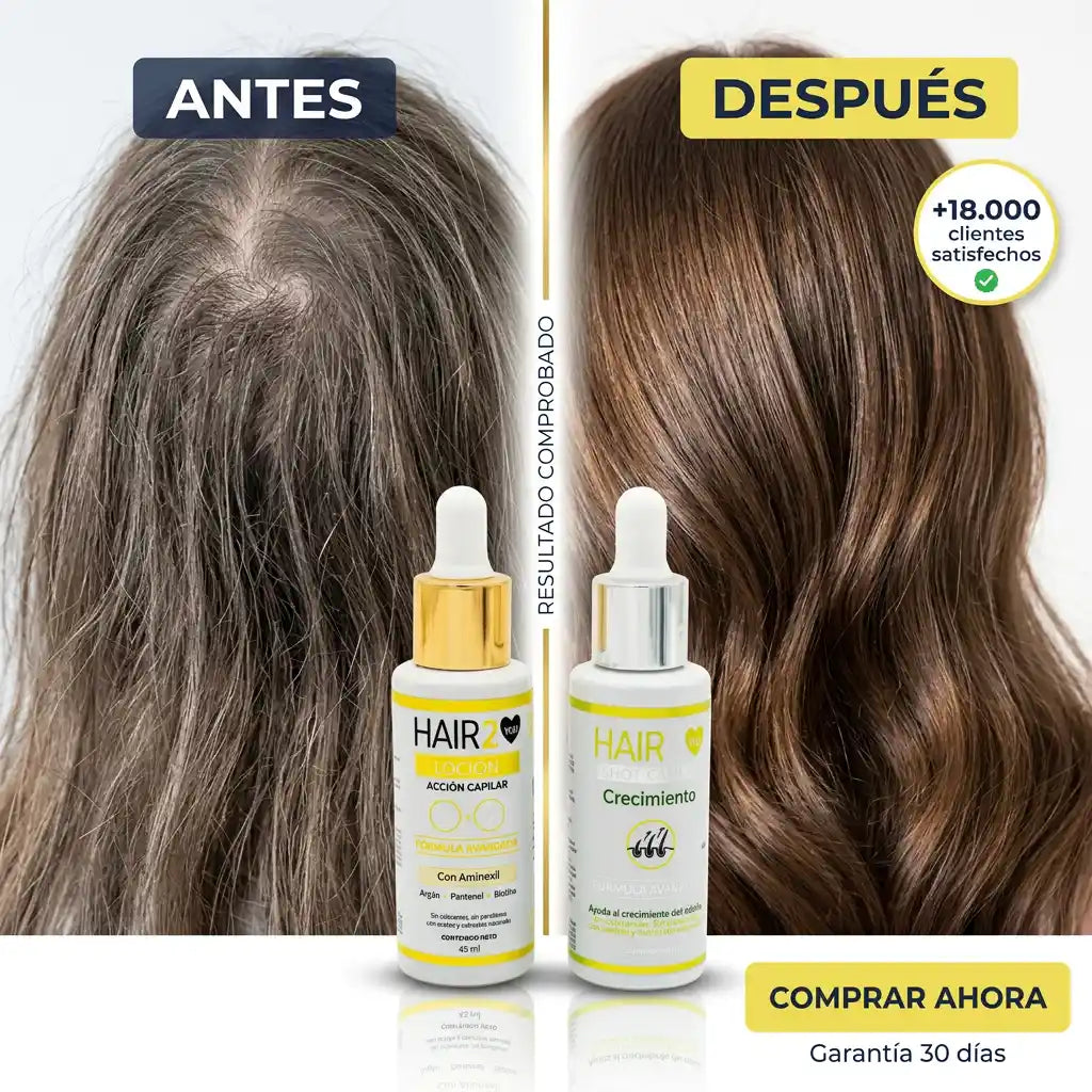Locion Capilar + Shot de Crecimiento - Elimina la calvicie y control el crecimiento del cabello