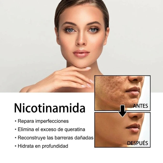 Sérum de nicotinamida para manchas Post-Acné