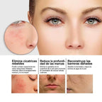 Sérum de nicotinamida para manchas Post-Acné